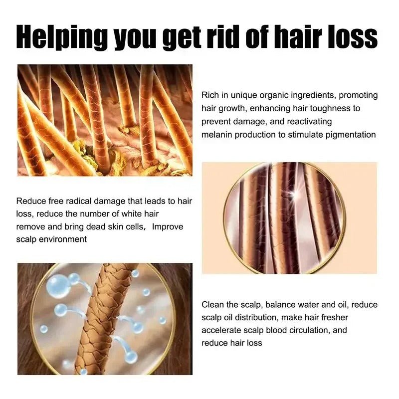 Hair Growth Oil Effective Rapid Repair Fast Baldness Hair Postpartum Hair Loss Follicles Hereditary Hair Loss Hair Care Solution.