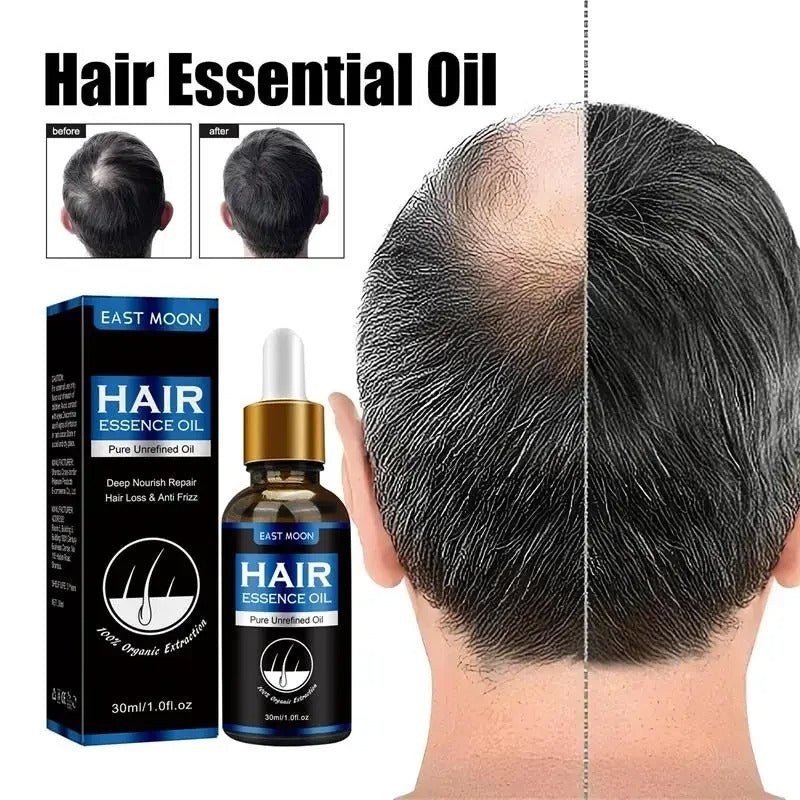Hair Growth Oil Effective Rapid Repair Fast Baldness Hair Postpartum Hair Loss Follicles Hereditary Hair Loss Hair Care Solution.