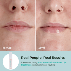 Liquid Balm – Hydrate, Plump & Shine in One Swipe!.